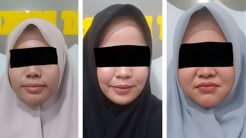 Sisi Gelap Banda Aceh